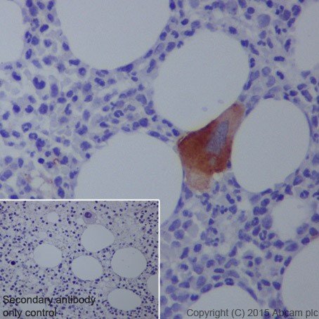 Immunohistochemistry (Formalin/PFA-fixed paraffin-embedded sections) - Anti-CD42b antibody [EPR19204] (AB210407), expandable thumbnail