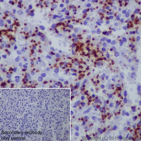 Immunohistochemistry (Formalin/PFA-fixed paraffin-embedded sections) - Anti-CD42b antibody [EPR19204] (AB210407), expandable thumbnail