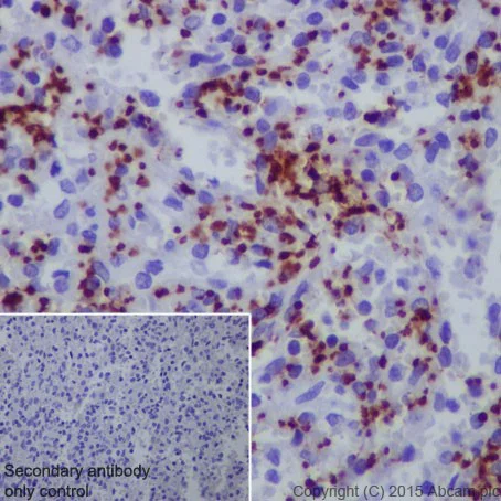 Immunohistochemistry (Formalin/PFA-fixed paraffin-embedded sections) - Anti-CD42b antibody [EPR19204] (AB210407)