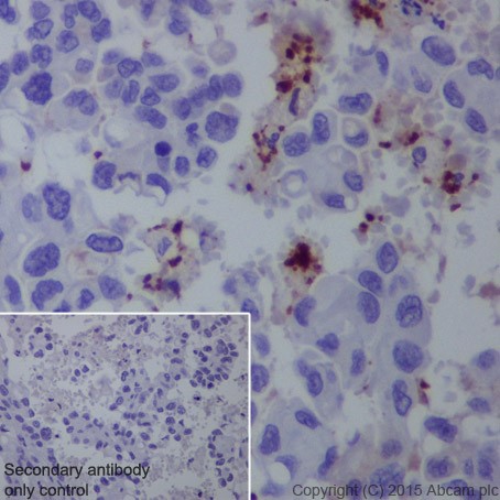 Immunohistochemistry (Formalin/PFA-fixed paraffin-embedded sections) - Anti-CD42b antibody [EPR19204] (AB210407), expandable thumbnail