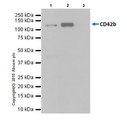 Immunoprecipitation - Anti-CD42b antibody [EPR19204] (AB210407), expandable thumbnail