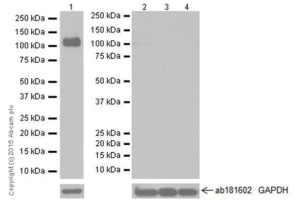 Western blot - Anti-CD42b antibody [EPR19204] (AB210407), expandable thumbnail