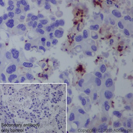 Immunohistochemistry (Formalin/PFA-fixed paraffin-embedded sections) - Anti-CD42b antibody [EPR19204] - BSA and Azide free (AB251517)
