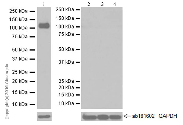 Western blot - Anti-CD42b antibody [EPR19204] - BSA and Azide free (AB251517)