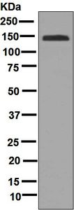 Western blot - Anti-CD42b antibody [EPR6995] (AB134087)
