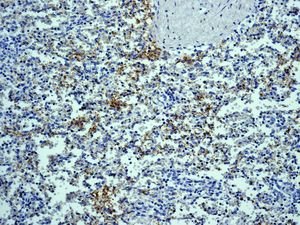 Immunohistochemistry (Formalin/PFA-fixed paraffin-embedded sections) - Anti-CD42b antibody [EPR6995] - Low endotoxin, Azide free (AB221213), expandable thumbnail