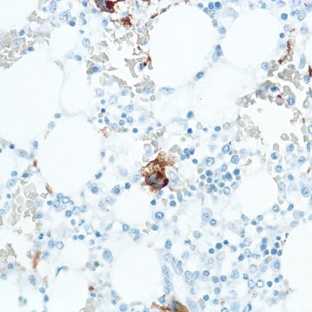 Immunohistochemistry (Formalin/PFA-fixed paraffin-embedded sections) - Anti-CD42b antibody [SP202] (ab227669), expandable thumbnail