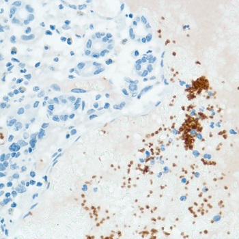 Immunohistochemistry (Formalin/PFA-fixed paraffin-embedded sections) - Anti-CD42b antibody [SP202] (AB227669), expandable thumbnail