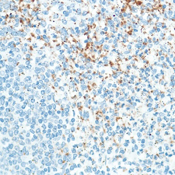 Immunohistochemistry (Formalin/PFA-fixed paraffin-embedded sections) - Anti-CD42b antibody [SP202] (AB227669), expandable thumbnail
