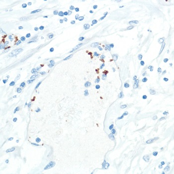 Immunohistochemistry (Formalin/PFA-fixed paraffin-embedded sections) - Anti-CD42b antibody [SP202] (AB227669), expandable thumbnail