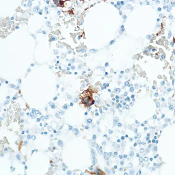 Immunohistochemistry (Formalin/PFA-fixed paraffin-embedded sections) - Anti-CD42b antibody [SP202] - BSA and Azide free (AB240406)