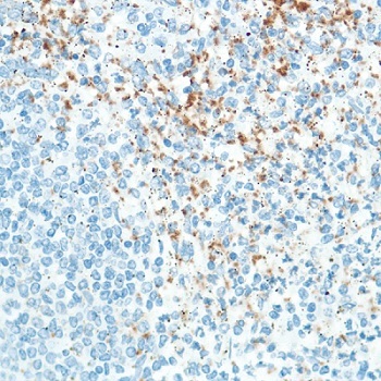 Immunohistochemistry (Formalin/PFA-fixed paraffin-embedded sections) - Anti-CD42b antibody [SP202] - BSA and Azide free (AB240406), expandable thumbnail