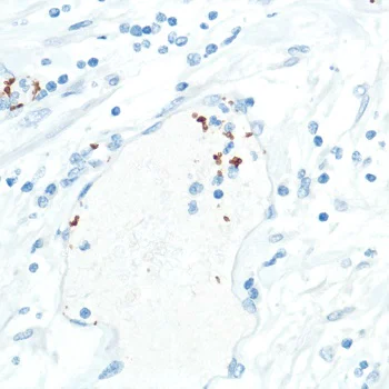 Immunohistochemistry (Formalin/PFA-fixed paraffin-embedded sections) - Anti-CD42b antibody [SP202] - BSA and Azide free (AB240406)