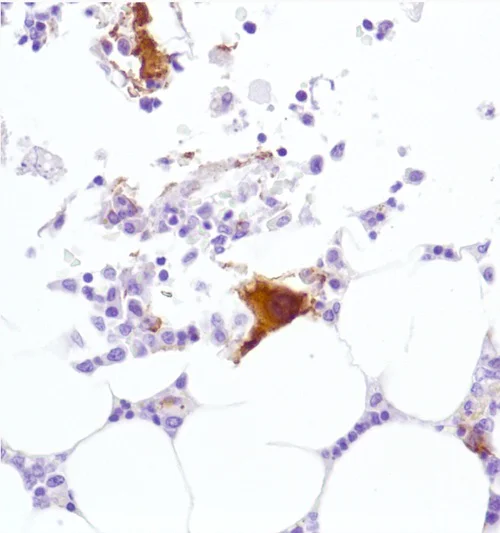 Immunohistochemistry (Formalin/PFA-fixed paraffin-embedded sections) - Anti-CD42b antibody [SP219] (AB183345)