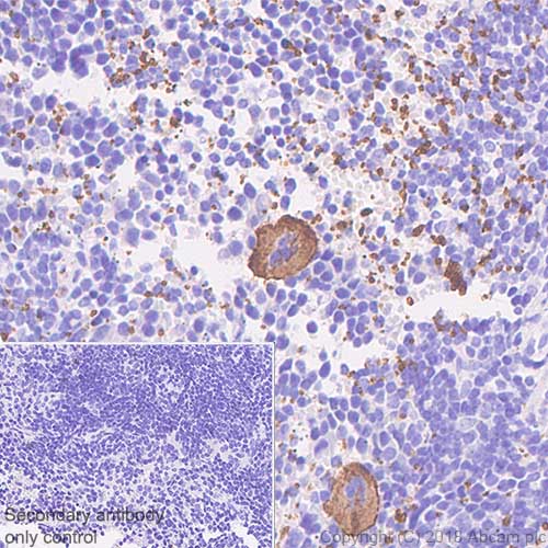 Immunohistochemistry (Formalin/PFA-fixed paraffin-embedded sections) - Anti-CD42b antibody [SP219] (AB183345), expandable thumbnail