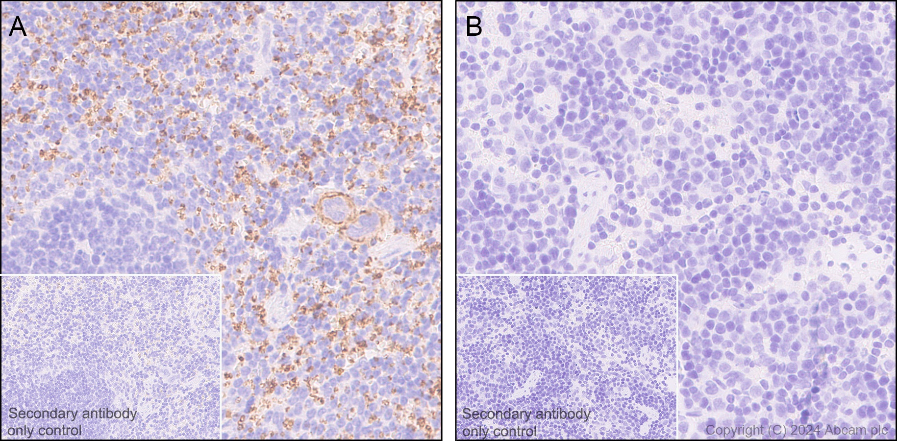 Immunohistochemistry (Formalin/PFA-fixed paraffin-embedded sections) - Anti-CD42b antibody [SP219] (ab183345), expandable thumbnail