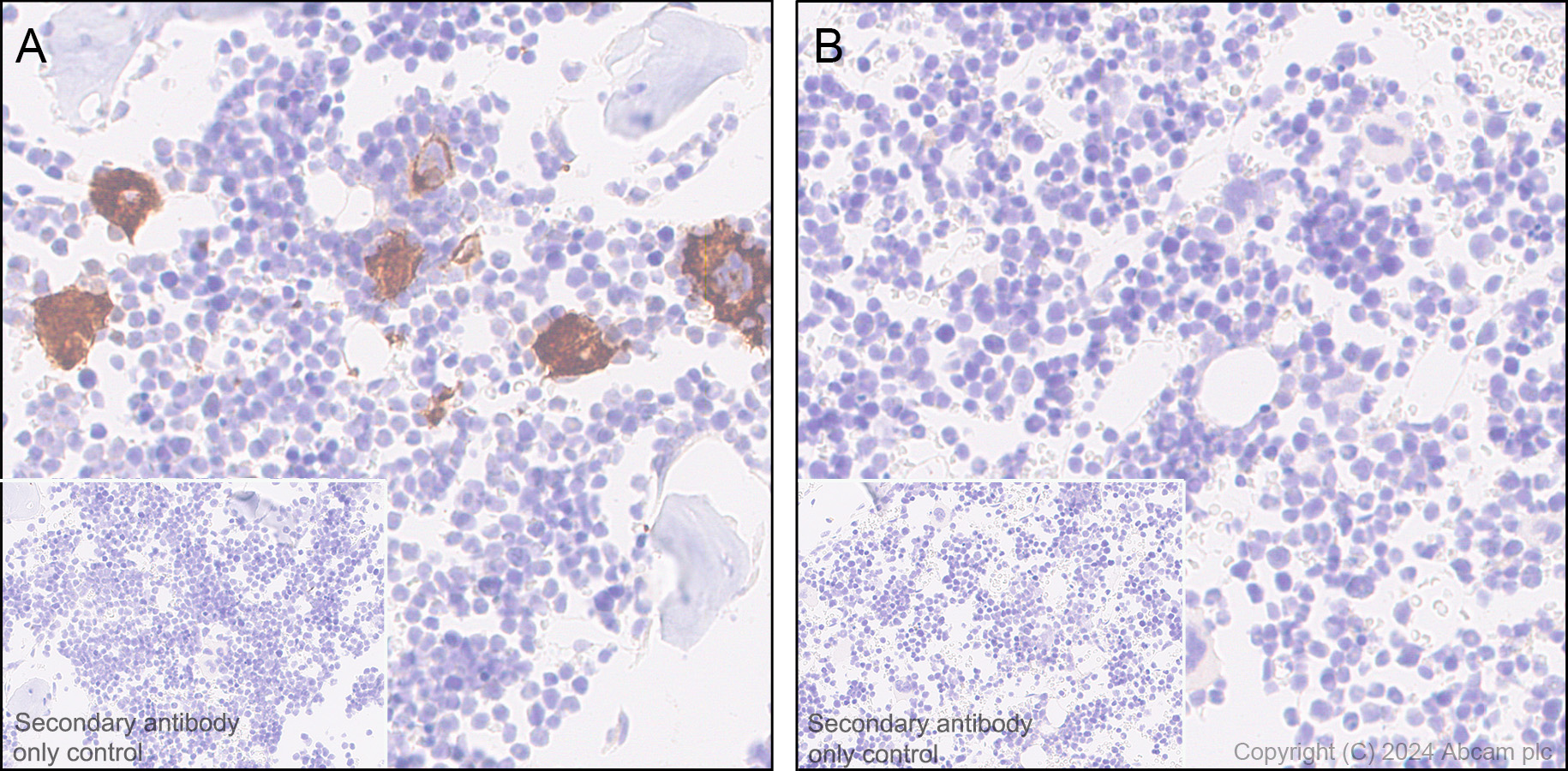 Immunohistochemistry (Formalin/PFA-fixed paraffin-embedded sections) - Anti-CD42b antibody [SP219] (ab183345), expandable thumbnail