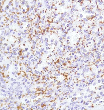 Immunohistochemistry (Formalin/PFA-fixed paraffin-embedded sections) - Anti-CD42b antibody [SP219] (AB183345)