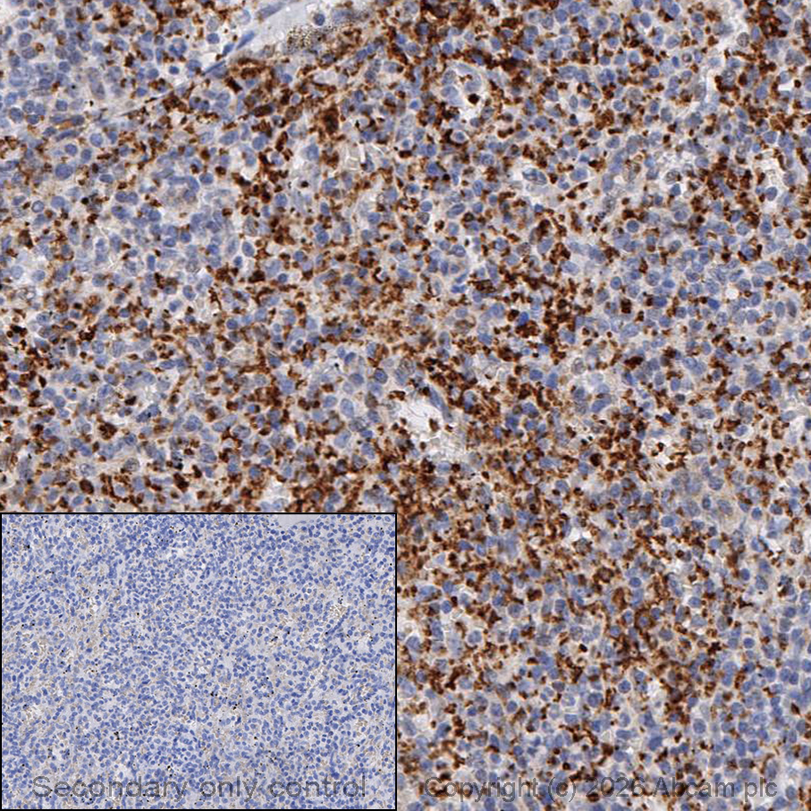 Immunohistochemistry (Formalin/PFA-fixed paraffin-embedded sections) - Anti-CD42b antibody [SP219] (AB183345)