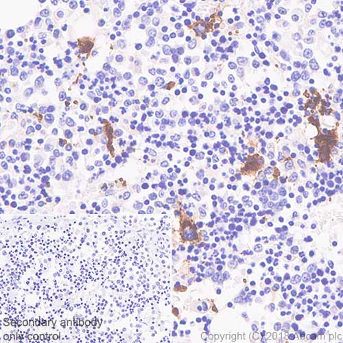 Immunohistochemistry (Formalin/PFA-fixed paraffin-embedded sections) - Anti-CD42b antibody [SP219] (AB183345), expandable thumbnail