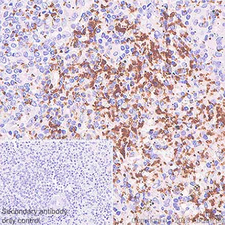 Immunohistochemistry (Formalin/PFA-fixed paraffin-embedded sections) - Anti-CD42b antibody [SP219] (AB183345)