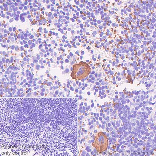 Immunohistochemistry (Formalin/PFA-fixed paraffin-embedded sections) - Anti-CD42b antibody [SP219] - BSA and Azide free (AB240268)
