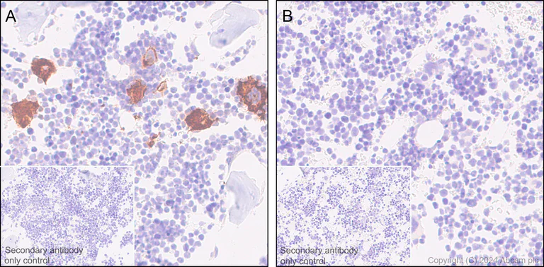 Immunohistochemistry (Formalin/PFA-fixed paraffin-embedded sections) - Anti-CD42b antibody [SP219] - BSA and Azide free (AB240268)