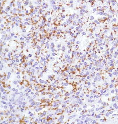 Immunohistochemistry (Formalin/PFA-fixed paraffin-embedded sections) - Anti-CD42b antibody [SP219] - Low endotoxin, Azide free (AB246709)