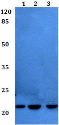Western blot - Anti-CD42c/GP1BB antibody (AB192541), expandable thumbnail