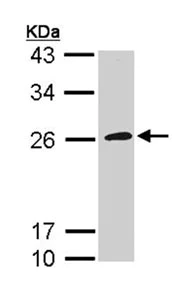 Western blot - Anti-CD42c/GP1BB antibody (AB96565)