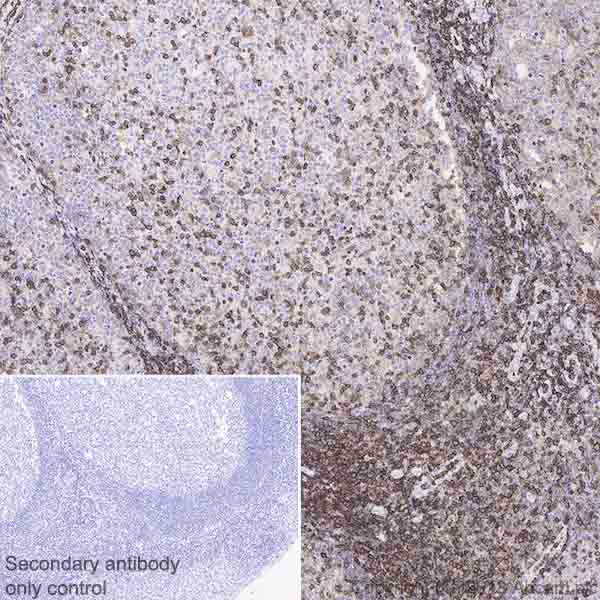 Immunohistochemistry (Formalin/PFA-fixed paraffin-embedded sections) - Anti-CD43 antibody [EPR21903] (AB235452)