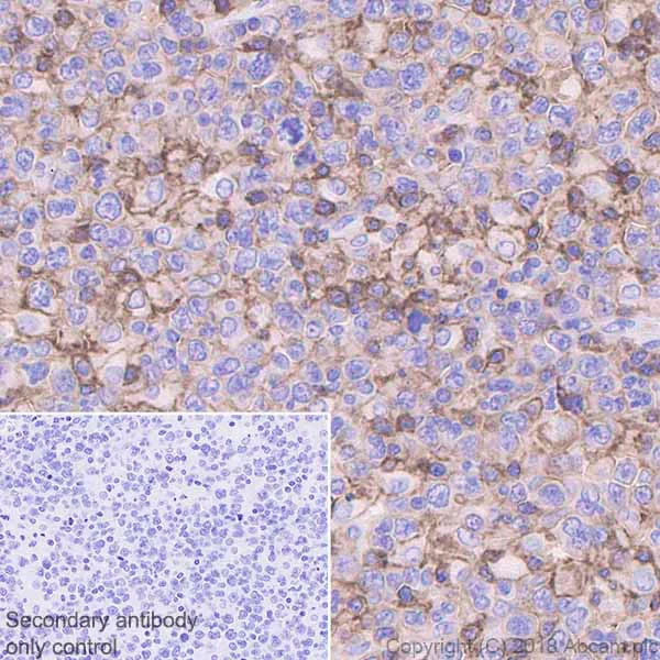 Immunohistochemistry (Formalin/PFA-fixed paraffin-embedded sections) - Anti-CD43 antibody [EPR21903] - BSA and Azide free (AB236556)
