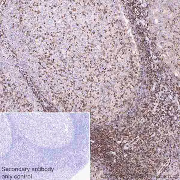 Immunohistochemistry (Formalin/PFA-fixed paraffin-embedded sections) - Anti-CD43 antibody [EPR21903] - BSA and Azide free (AB236556)