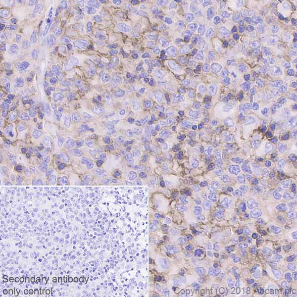 Immunohistochemistry (Formalin/PFA-fixed paraffin-embedded sections) - Anti-CD43 antibody [EPR21904] - BSA and Azide free (AB236548), expandable thumbnail