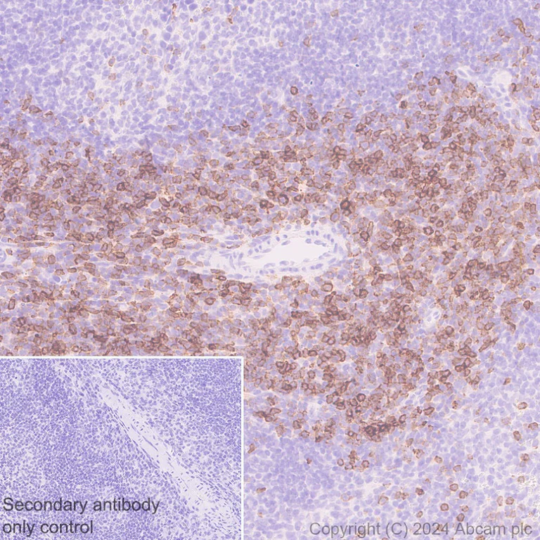Immunohistochemistry (Formalin/PFA-fixed paraffin-embedded sections) - Anti-CD43 antibody [EPR28619-85] (AB317313)