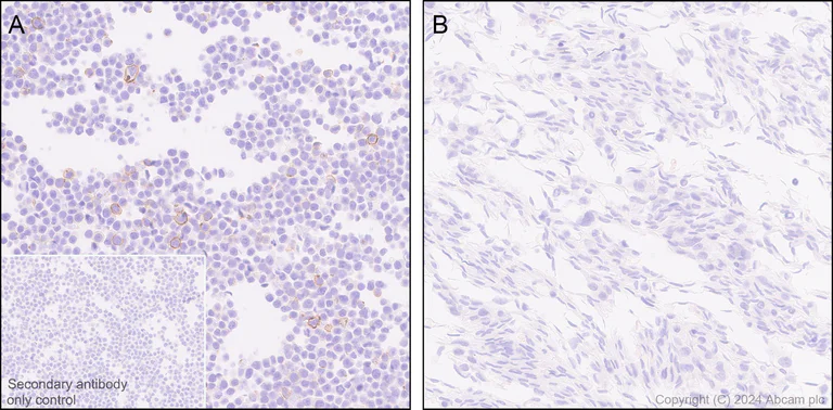 Immunohistochemistry (Formalin/PFA-fixed paraffin-embedded sections) - Anti-CD43 antibody [EPR28619-85] (AB317313)