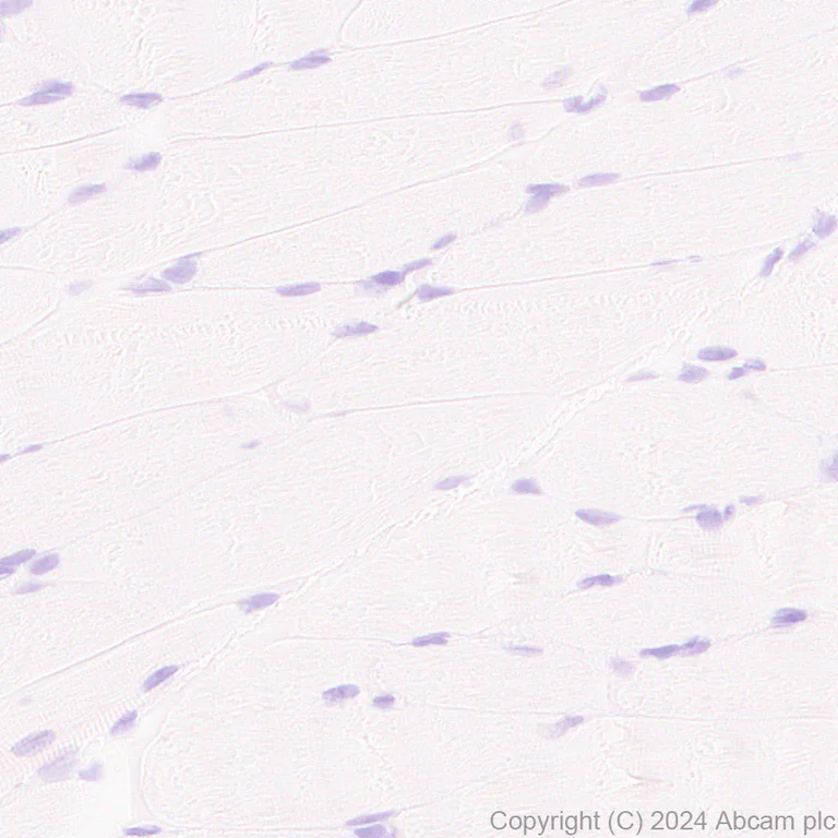 Immunohistochemistry (Formalin/PFA-fixed paraffin-embedded sections) - Anti-CD43 antibody [EPR28619-85] - BSA and Azide free (AB317314)