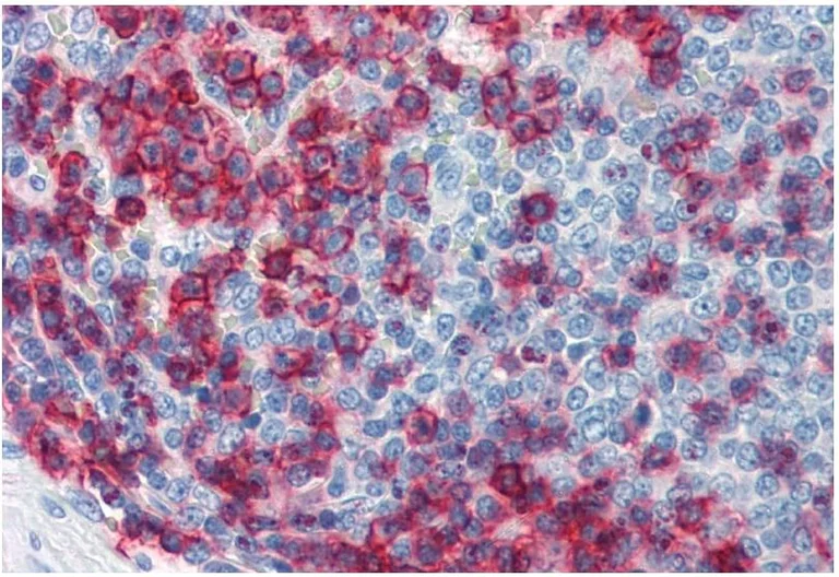Immunohistochemistry (Formalin/PFA-fixed paraffin-embedded sections) - Anti-CD43 antibody [MEM-59] (AB9088)