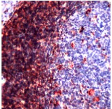 Immunohistochemistry (Formalin/PFA-fixed paraffin-embedded sections) - Anti-CD43 antibody [SP55] - BSA and Azide free (AB238799)