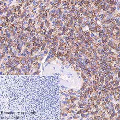 Immunohistochemistry (Formalin/PFA-fixed paraffin-embedded sections) - Anti-CD43 antibody [SP55] - BSA and Azide free (AB238799)