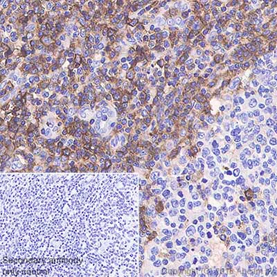 Immunohistochemistry (Formalin/PFA-fixed paraffin-embedded sections) - Anti-CD43 antibody [SP55] - BSA and Azide free (AB238799)