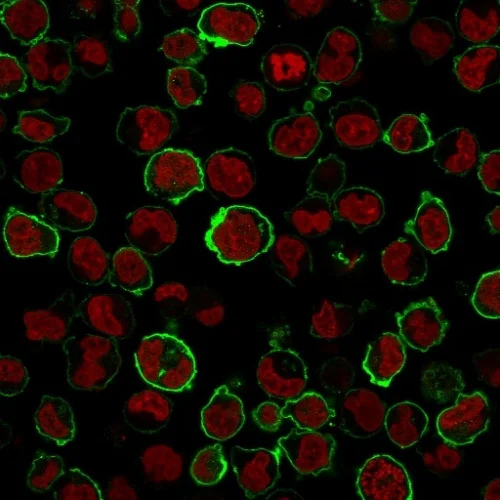 Immunocytochemistry - Anti-CD43 antibody [SPN/1766R] (AB218523)