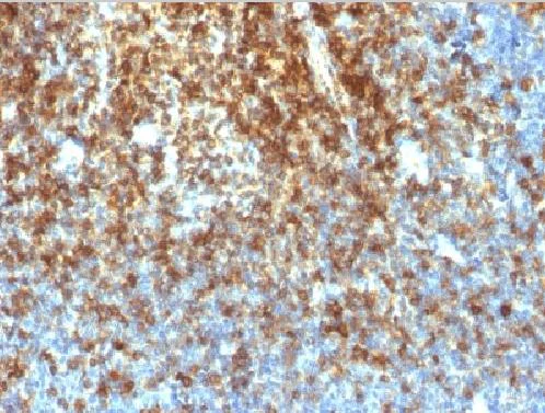 Immunohistochemistry (Formalin/PFA-fixed paraffin-embedded sections) - Anti-CD43 antibody [SPN/1766R] (AB218523)