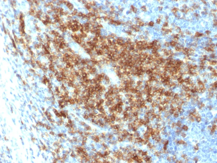 Immunohistochemistry (Formalin/PFA-fixed paraffin-embedded sections) - Anti-CD43 antibody [SPN/2049R] - BSA and Azide free (AB257327)