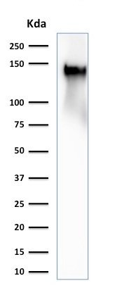 Western blot - Anti-CD43 antibody [SPN/2049R] - BSA and Azide free (AB257327), expandable thumbnail