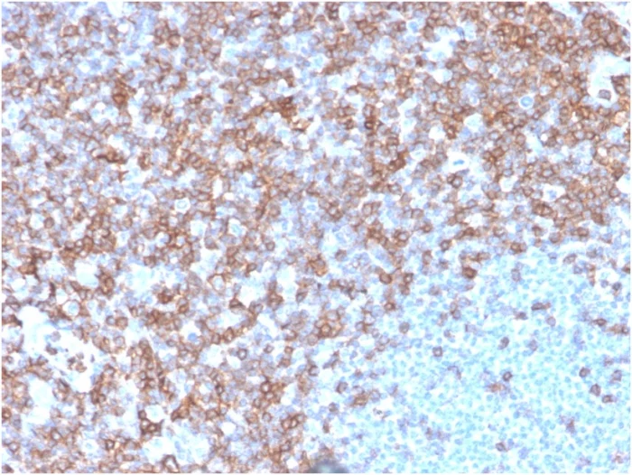 Immunohistochemistry (Formalin/PFA-fixed paraffin-embedded sections) - Anti-CD43 antibody [SPN/3388] - BSA and Azide free (AB257326)
