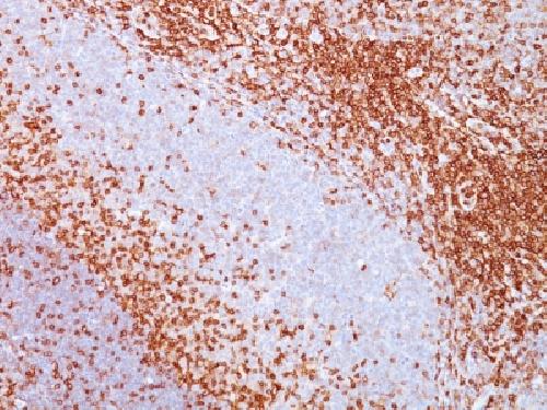 Immunohistochemistry (Formalin/PFA-fixed paraffin-embedded sections) - Anti-CD43 antibody [SPN/839] (AB233969), expandable thumbnail