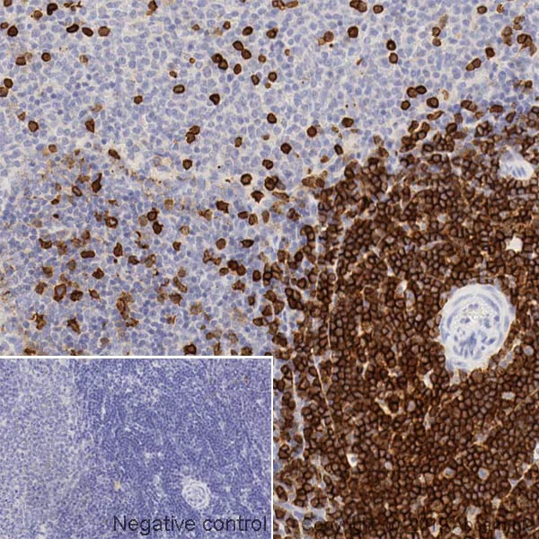 Immunohistochemistry (Formalin/PFA-fixed paraffin-embedded sections) - Anti-CD43 antibody [W3/13] - BSA and Azide free (AB244559)
