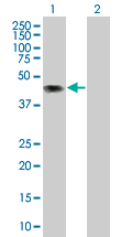 Western blot - CD43 overexpression 293T lysate (whole cell) (AB94089), expandable thumbnail