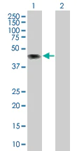 Western blot - CD43 overexpression 293T lysate (whole cell) (AB94089)